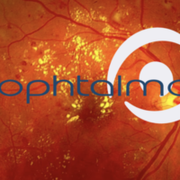 e-ophtalmo_Une