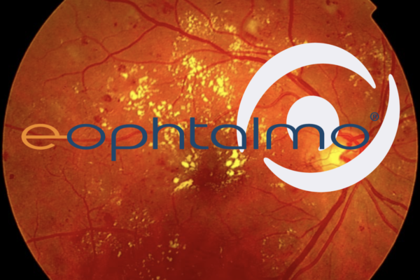 e-ophtalmo_Une